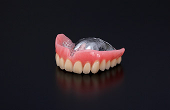 コバルトクロム合金