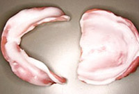 ティシュコンディショニング