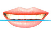 唇との調和イメージ