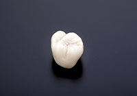 歯の特徴付けイメージ