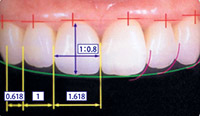 相対的歯冠長イメージ
