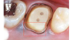 肉眼で見た写真