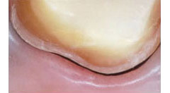 拡大ルーペで見た写真