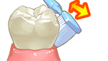 歯ブラシステップ1